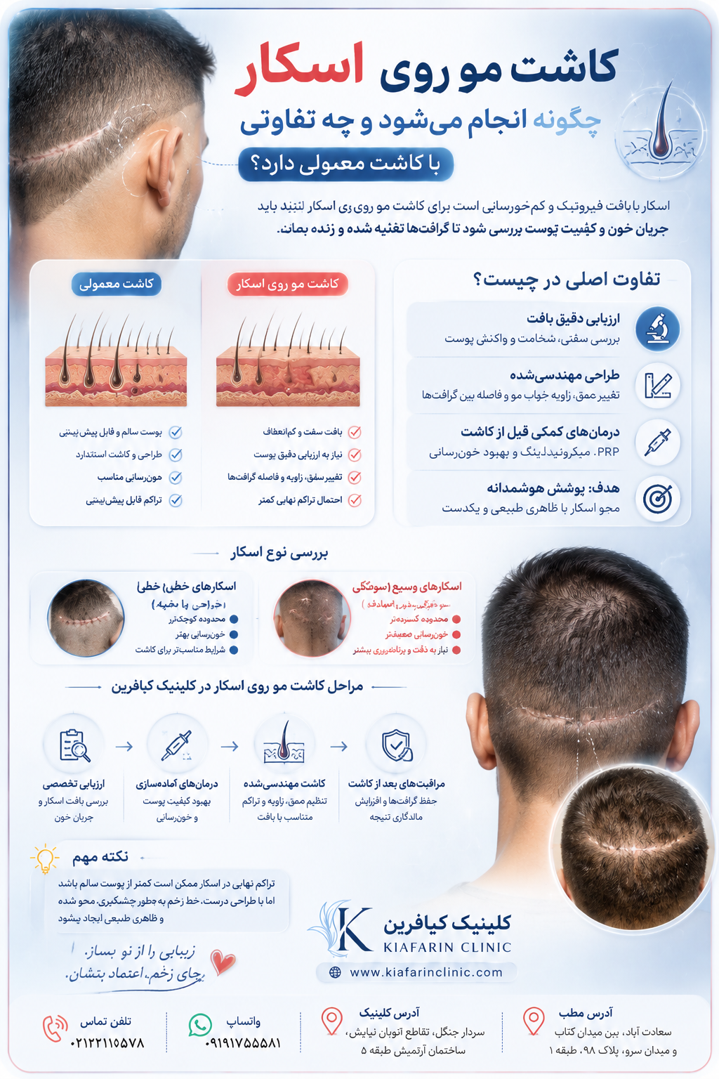 کاشت مو روی اسکار