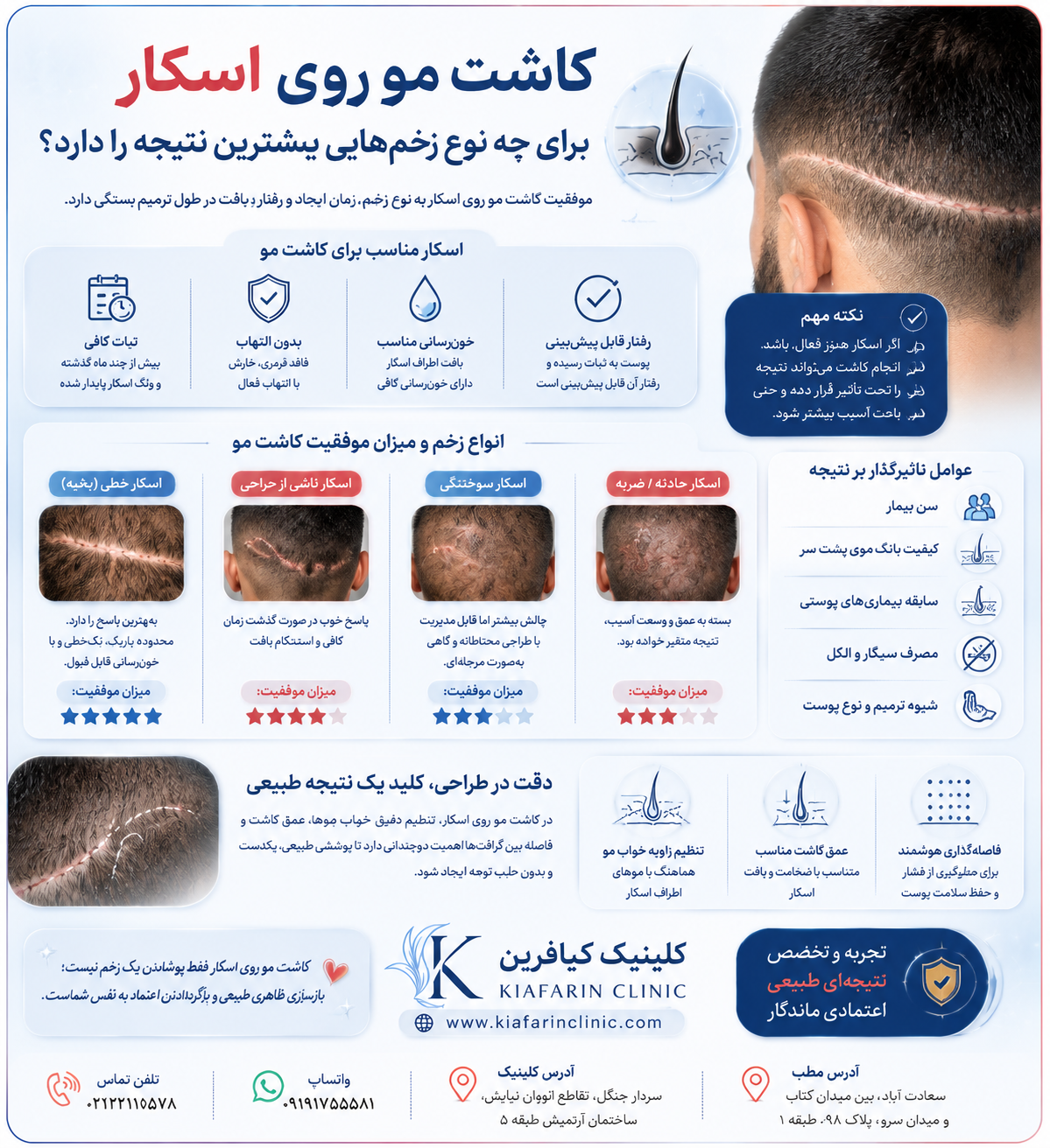 کاشت مو روی اسکار