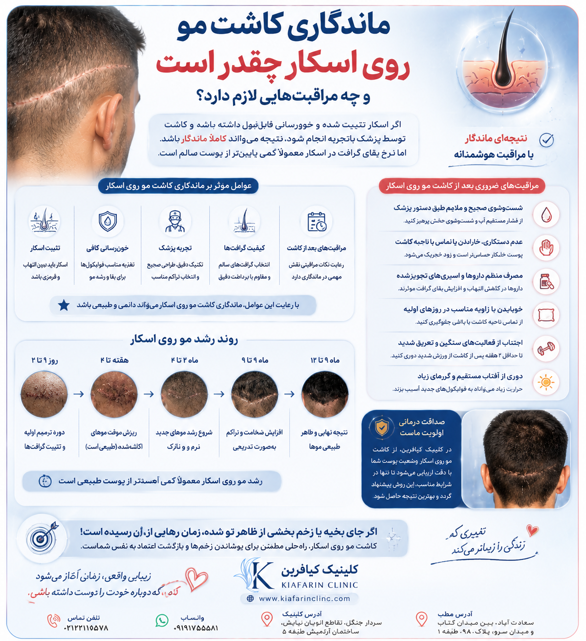 کاشت مو روی اسکار