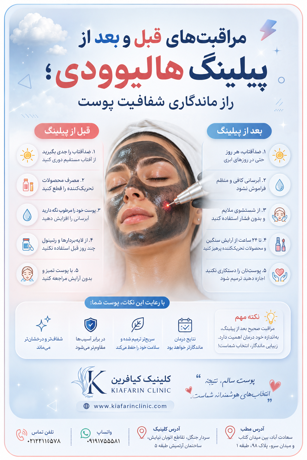 پیلینگ هالیوودی