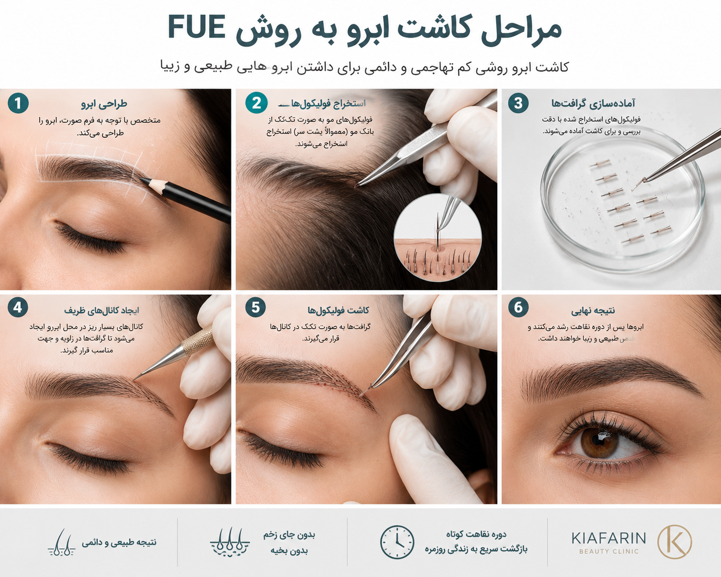چند روز بعد از کاشت ابرو، ظاهر آن طبیعی می‌شود؟