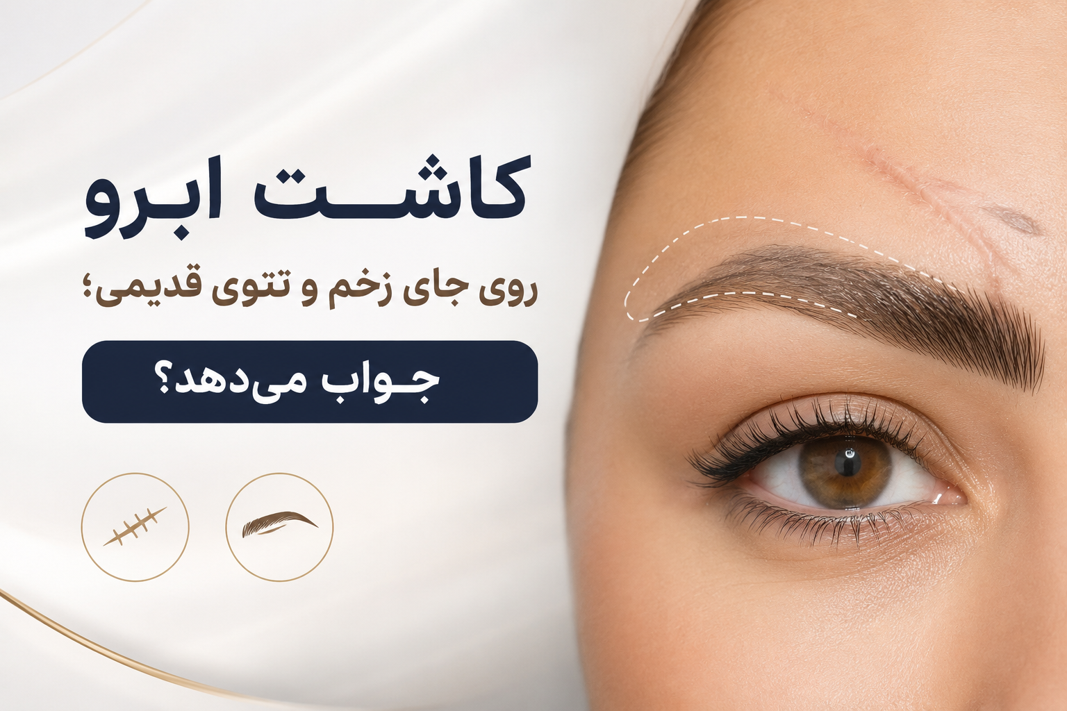 کاشت ابرو روی جای زخم و تتوی قدیمی؛ جواب می‌دهد؟