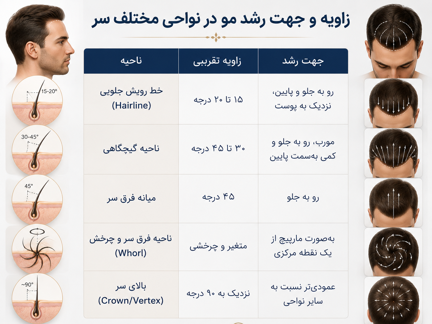 بهترین زاویه خواب مو در خط رویش طبیعی چیست؟