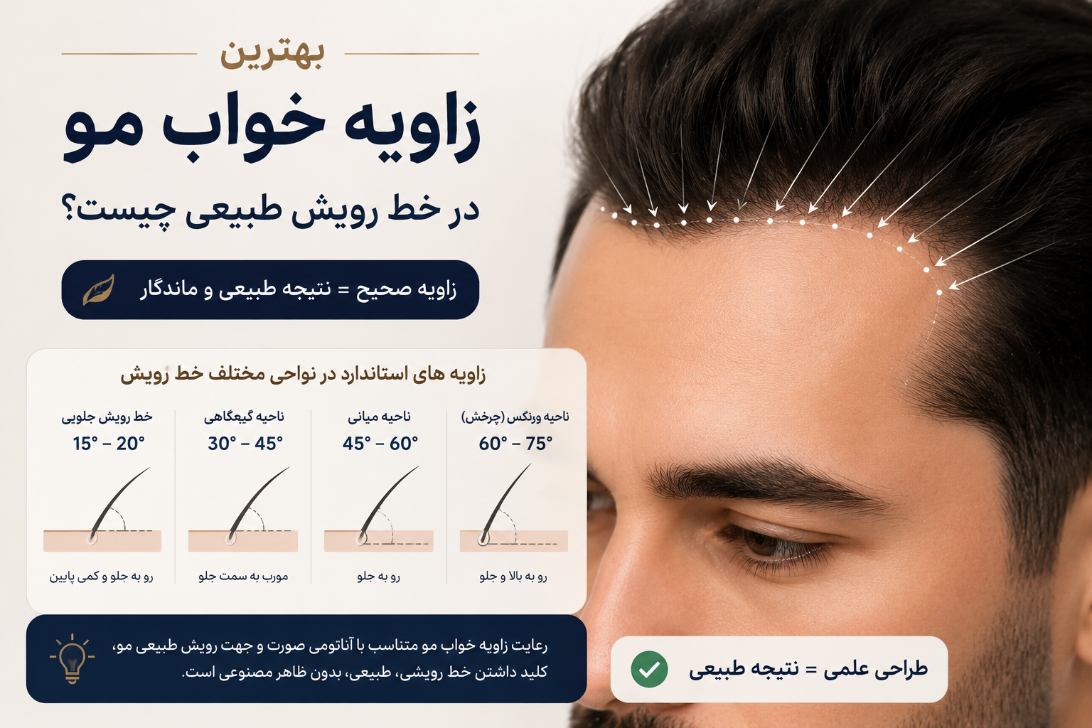 بهترین زاویه خواب مو در خط رویش طبیعی چیست؟