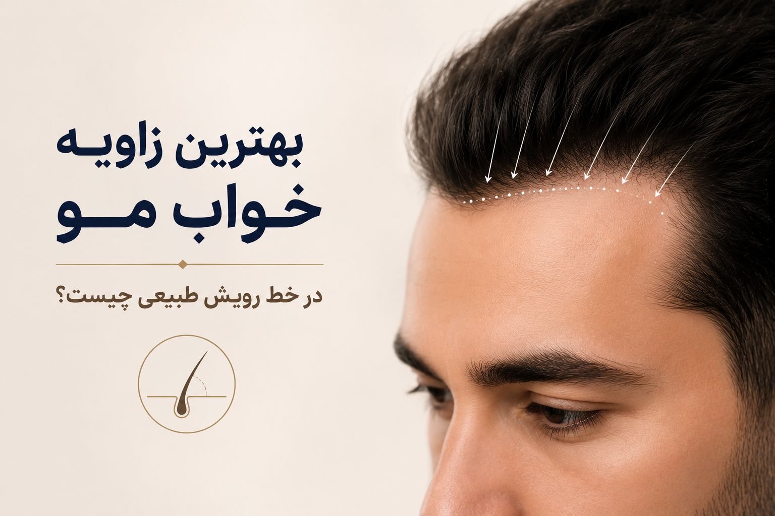 بهترین زاویه خواب مو در خط رویش