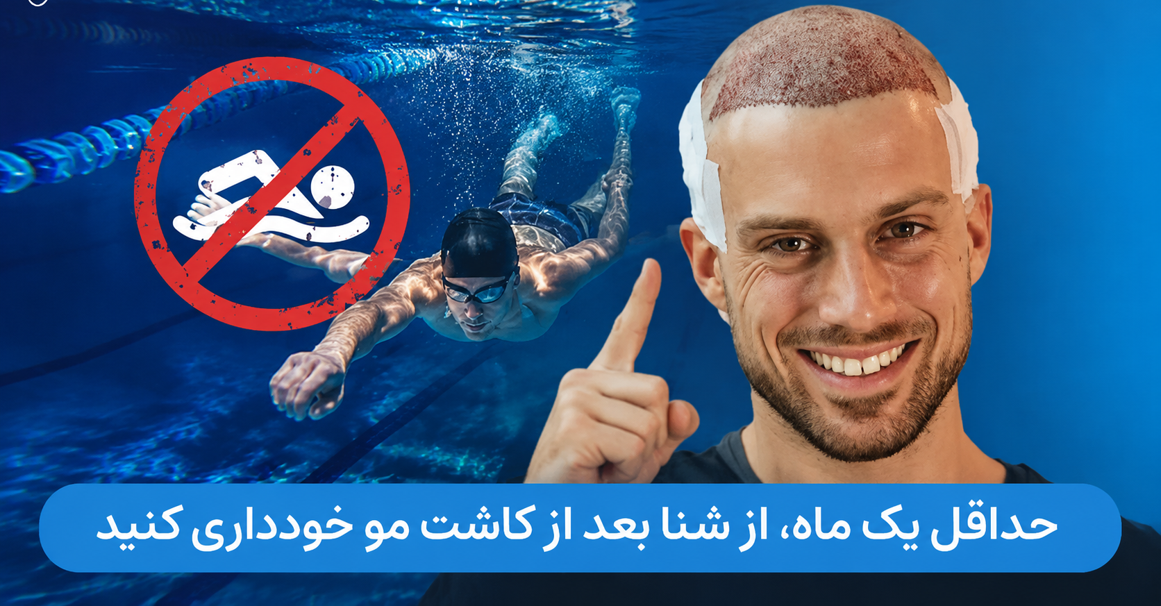 شنا بعد از کاشت مو؛ چند روز بعد میتوان استخر رفت؟