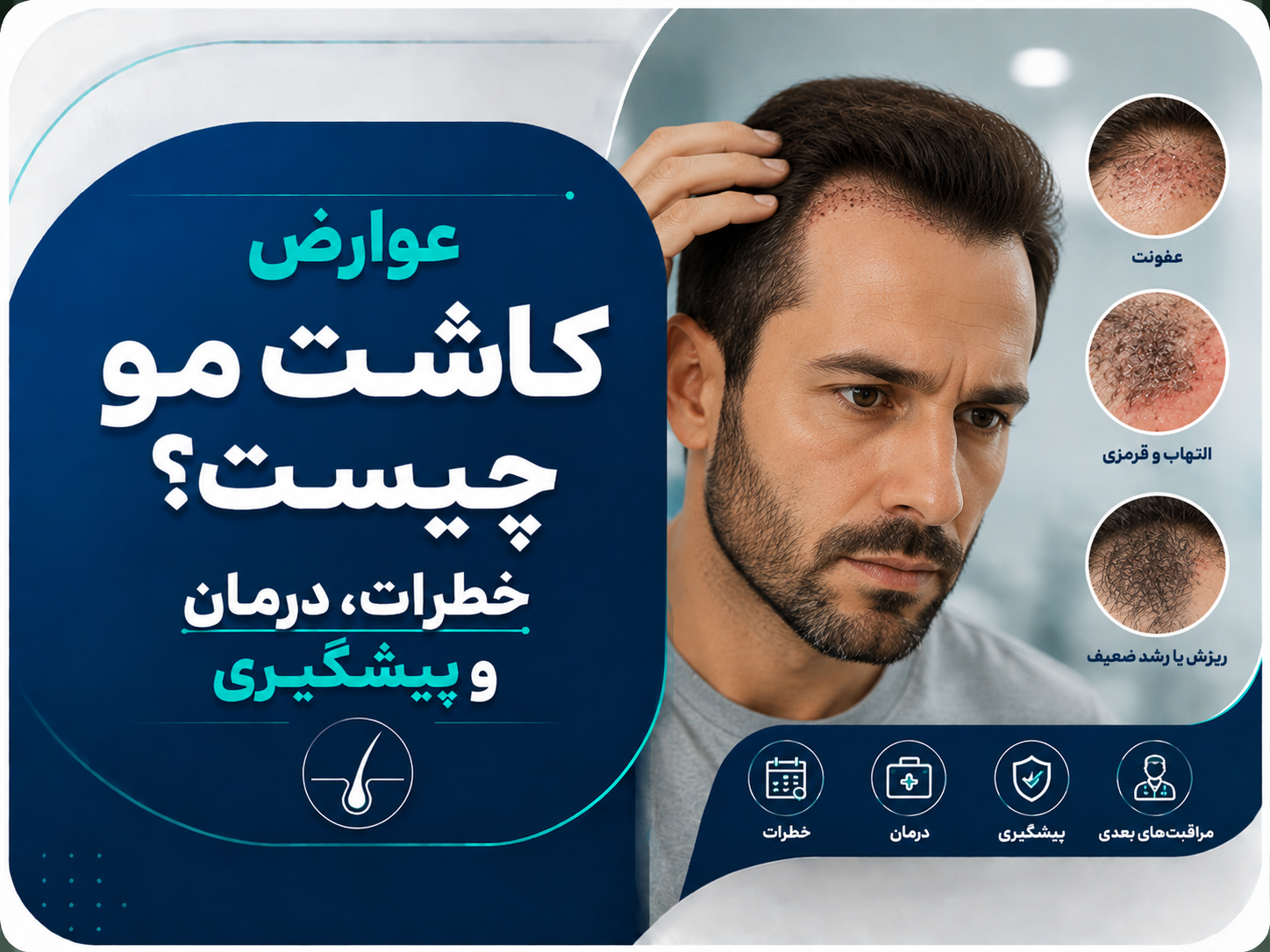 عوارض کاشت مو چیست؟ خطرات، درمان و پیشگیری